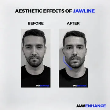 Jaw Enhance - Ultimate Facial Exerciser