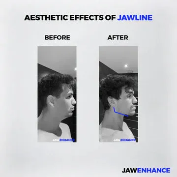 Jaw Enhance - Ultimate Facial Exerciser